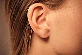 [OT:] Hopeful Tinnitus Treatment | next thread &raquo;