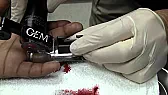 Removing Rings  | &laquo; previous thread
